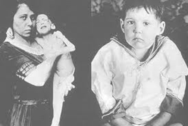 First Successful Use of Insulin