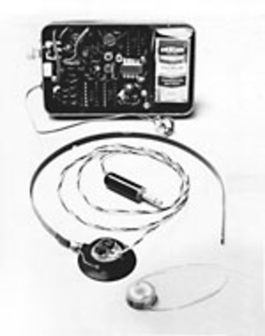 Cochlear Implant approved