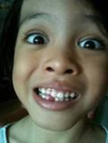 My first tooth lost!!!