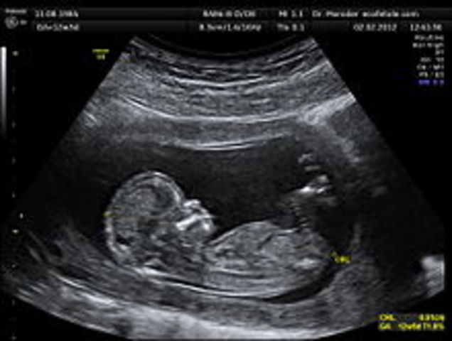 First commercial ultrasound