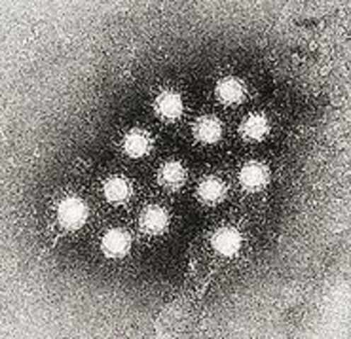 First vaccine for Hepatitis A available