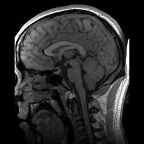 Raymond Damadian builds first commercial MRI scanner