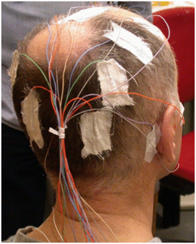William Grey Walter invents the brain EEG topography (toposcope)