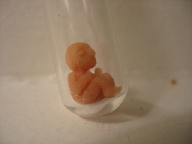 First test-tube baby is born