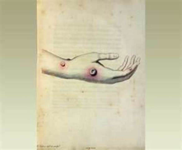 cow pox vaccine compulsary