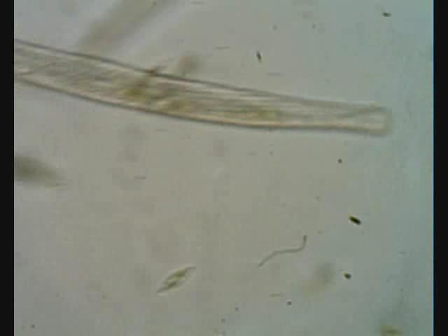 Barthelemy Dumortier discovered cell division in plants.