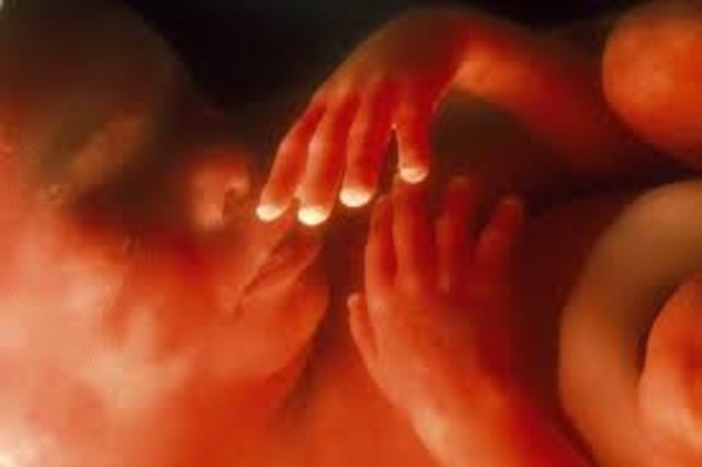 Fetal Development Month 7