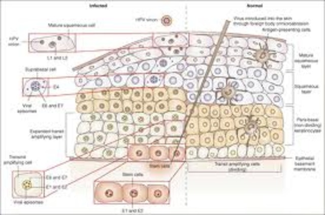 The Beginning of the End for Cervical Cancer