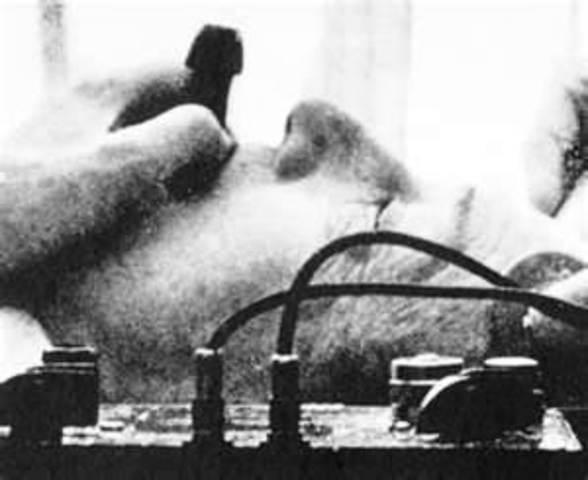 Electroconvulsive therapy