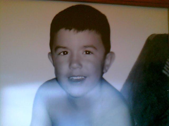 MI OPERACIÓN DE NARIZ