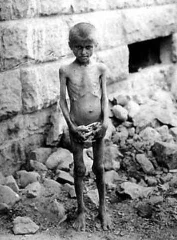 Method of Killing: Starvation