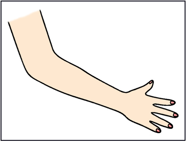 My dad almost lost all motion in his arm.