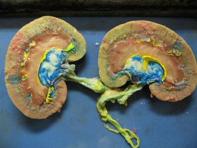 the world disabled alpine championship