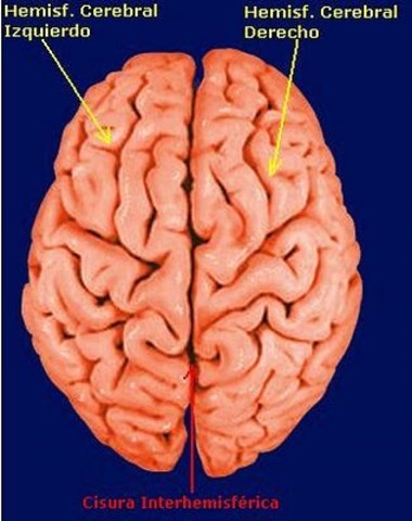 Hemisferios cerebrales