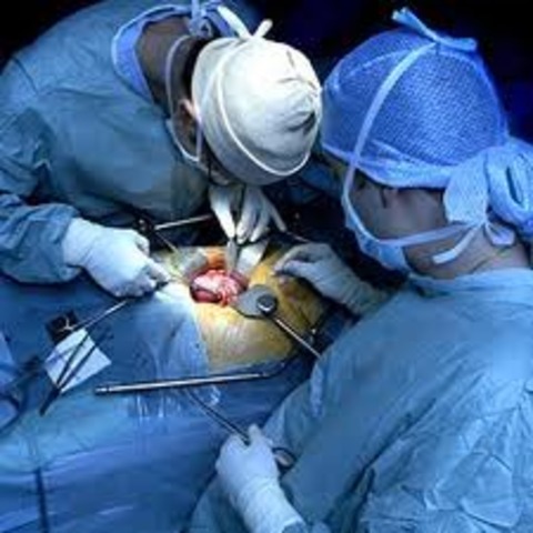 Kidney Transplant