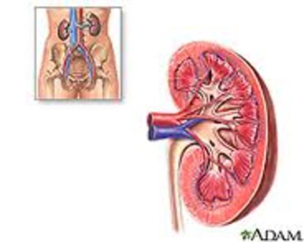Kidney Failure