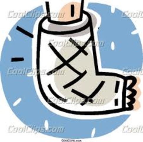 Yo rompi mi dedos del pie