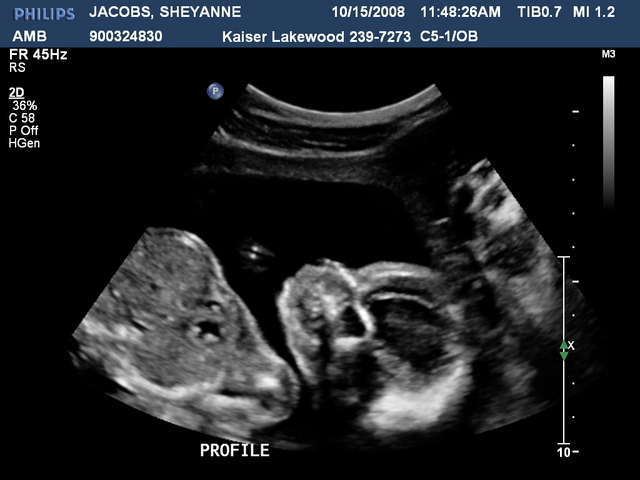 Date & Event of your choice #1