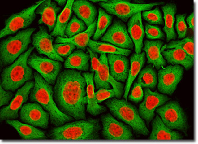 Gey and coworkers established a continuous human cell line