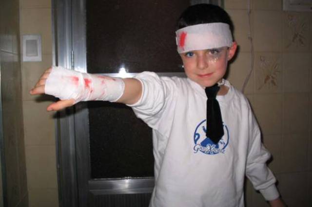 Dia dos machucados, na escola Gato Xadrez