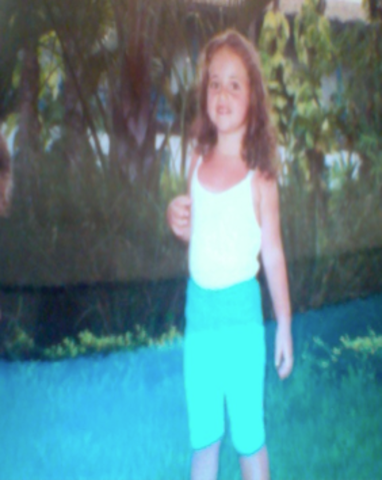 Terceiro ano- Queimadura