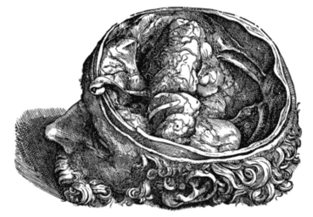 Vesalius Discovers  odern Anatomy