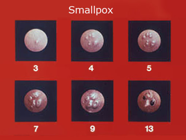 Smallpox Epidemic