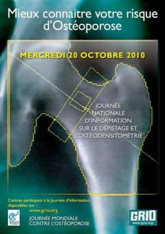 Journée Mondiale de l’Ostéoporose