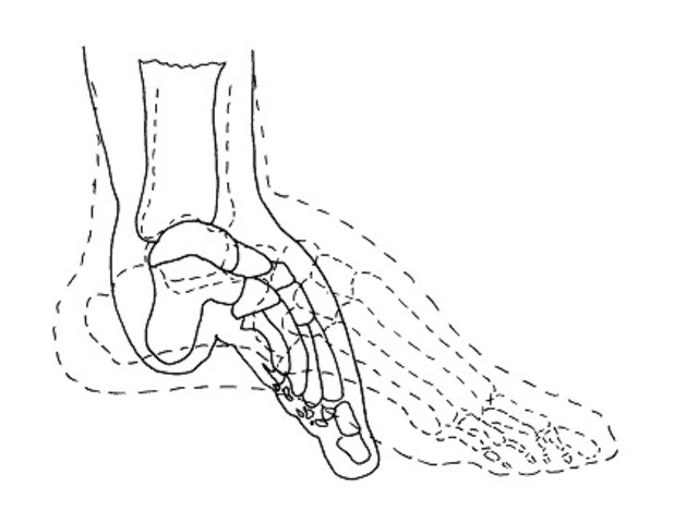 Foot Binding (social)
