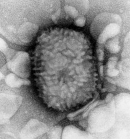 Smallpox are brought to America