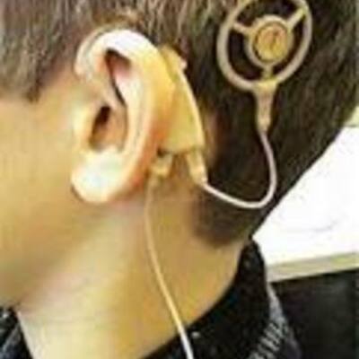 Timeline: History of the Cochlear Implant