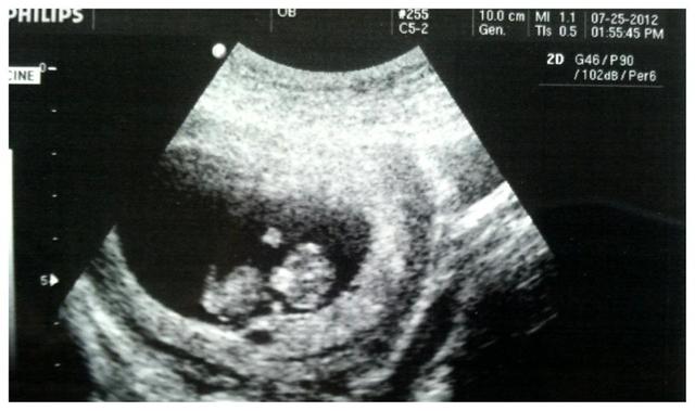 Found out we're going to be parents again :)