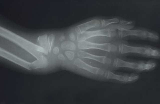 Fútbol en la Lluvia