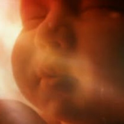 Timeline: Etapas de la Gestación