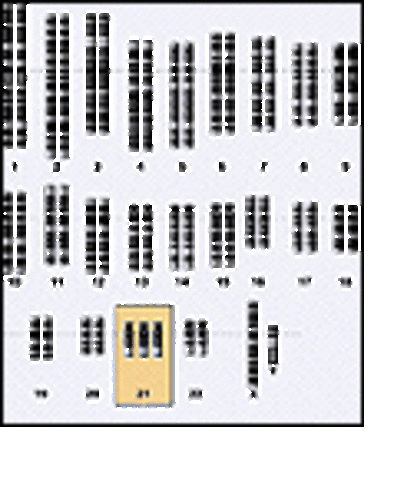 Chromosome Abnormalities Identified