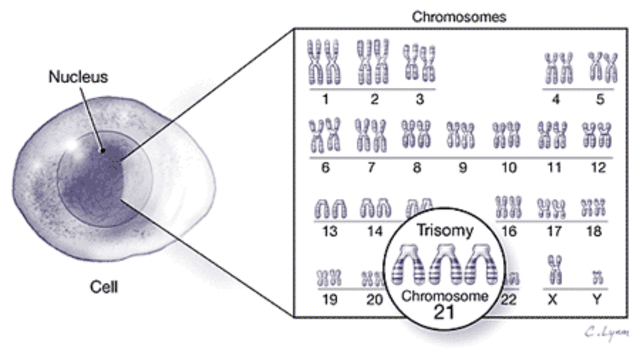Chromosome 21