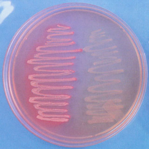 primeras explicaciones de la variación morfológica y fisiológica en bacterias