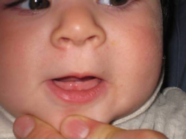 ¡¡ MI PRIMER DIENTE !!