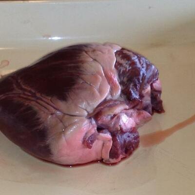 Timeline: Our Nicky's heart