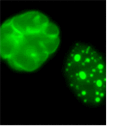 Premature Aging Gene Identified