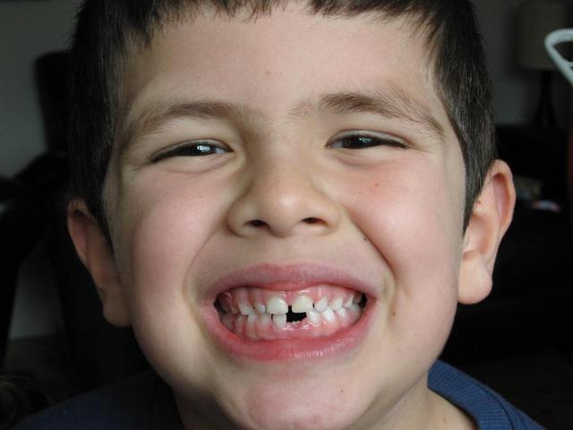 Se me cae mi primer diente