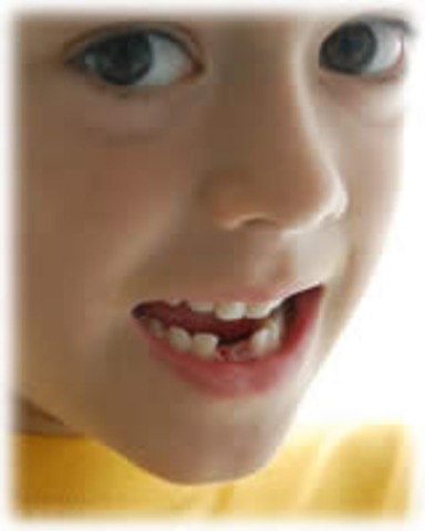 SE CAE MI PRIMER DIENTE