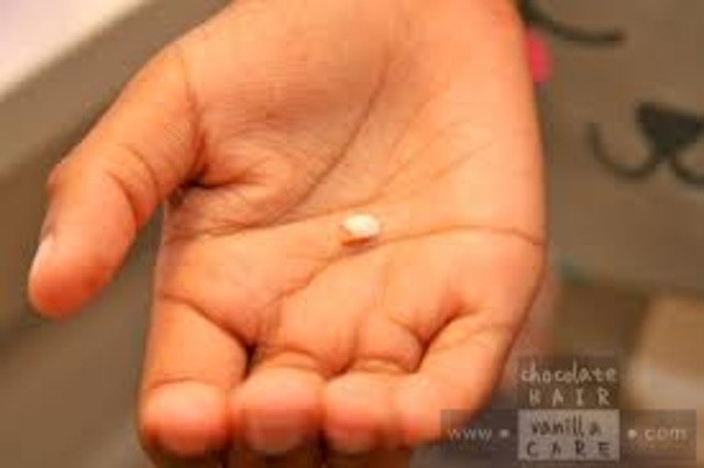 Lost my first two teeth