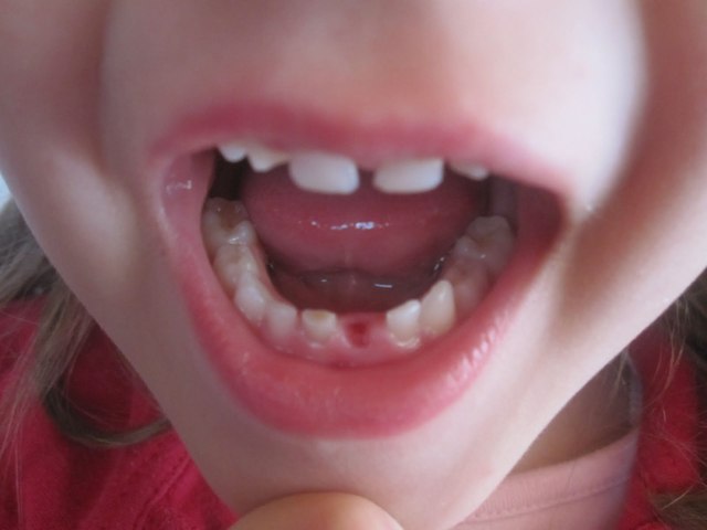 A CARLA SE LE CAE SU PRIMER DIENTE