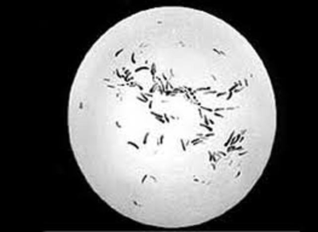 KOCH descobreix el bacil de la tuberculosi