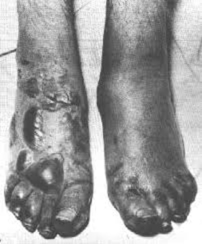 Life in the trenches