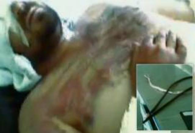 Hospitals mistreating patients