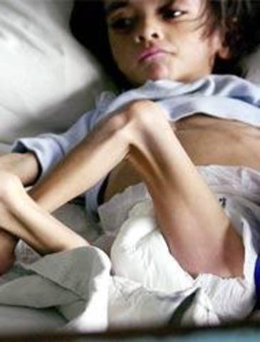 DESNUTRICIÓN POR IMC