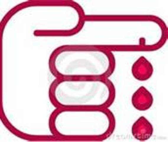 Finger bleded every were