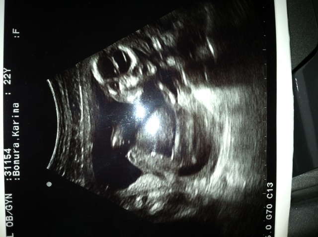 "First Doctor's Appointment"